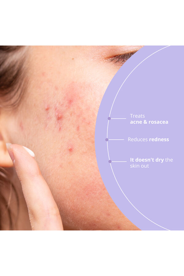 Freshly Cosmetics Azelaic Radiance blanco