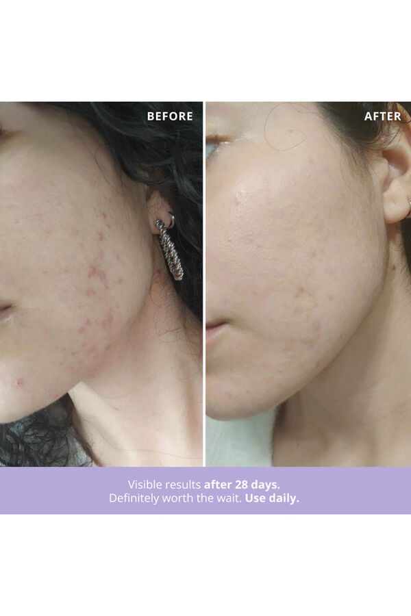 Freshly Cosmetics Azelaic Radiance blanco